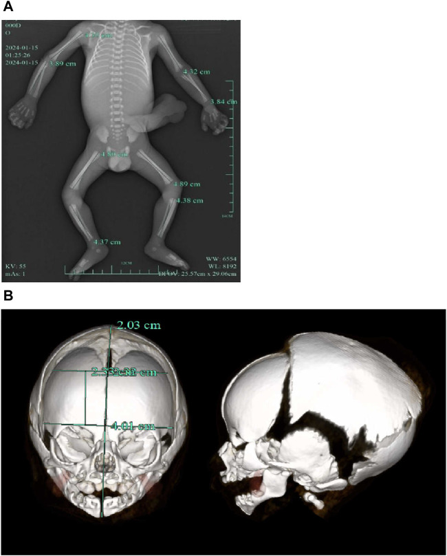 FIGURE 3