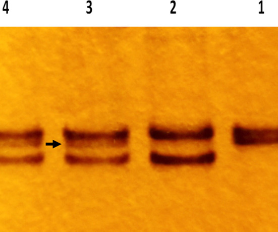 Fig.2