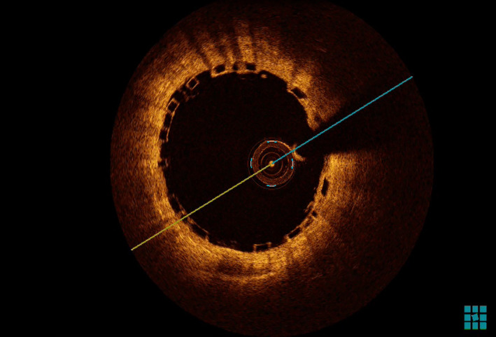 Figure 5