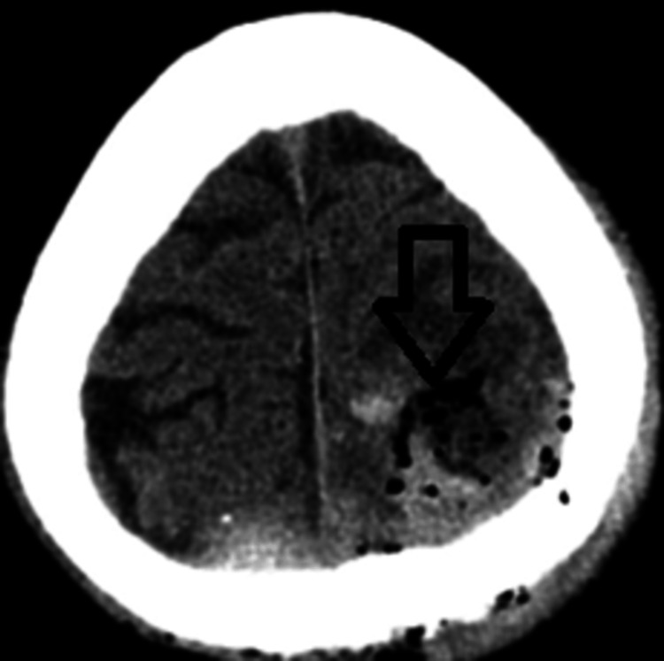 Figure 6