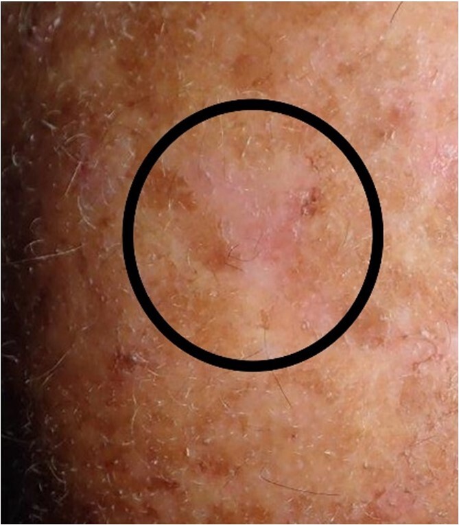 Figure 9