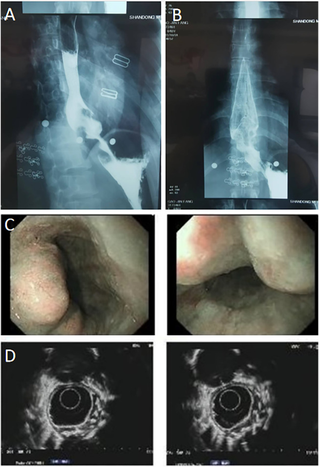 Figure 1