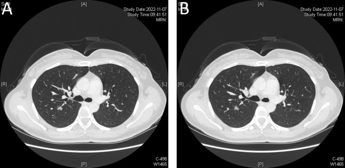 Figure 2