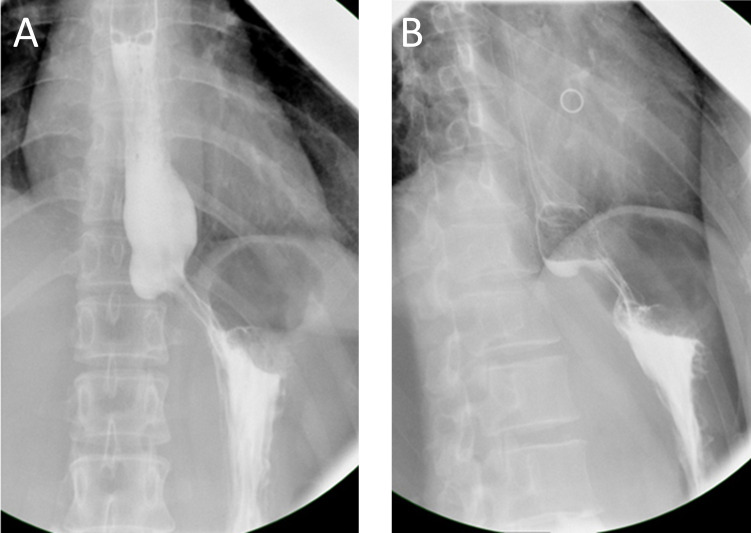 Figure 4