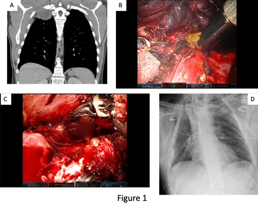 Figure 32