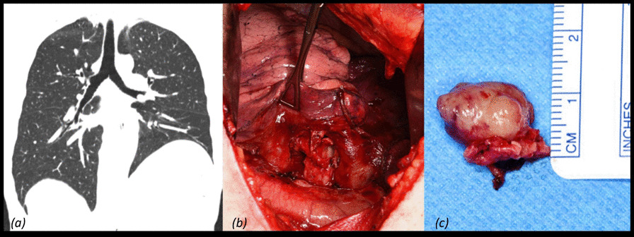 Figure 45