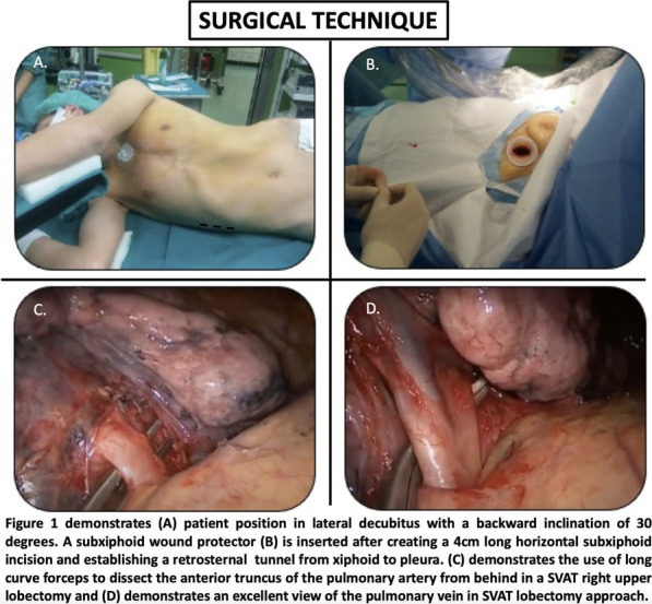 Figure 46