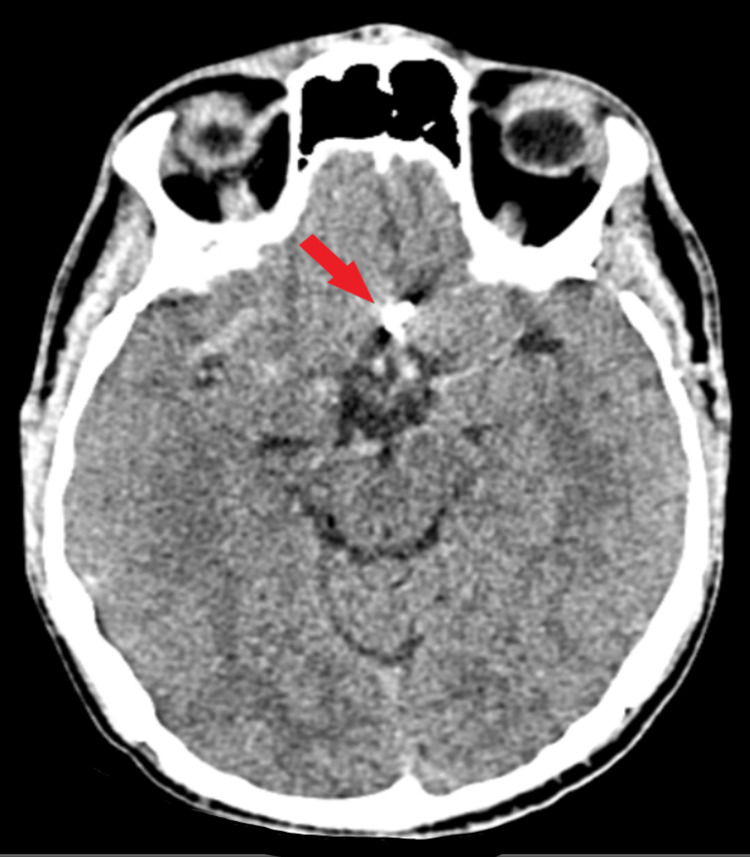 Figure 5