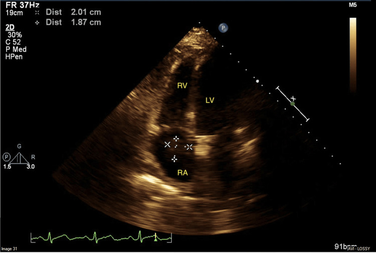 Figure 5