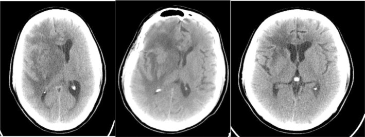 FIGURE 1