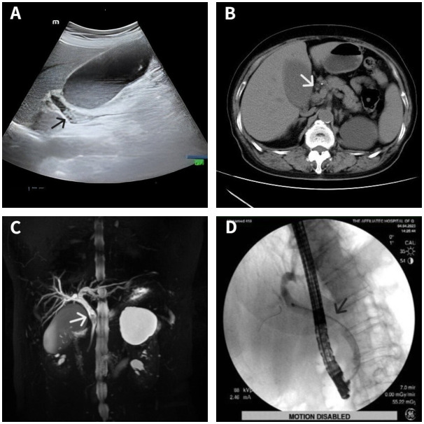 Figure 1