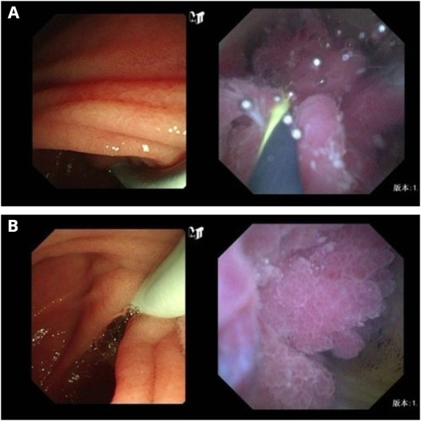 Figure 2