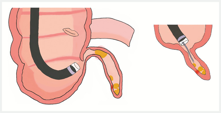 Fig. 5