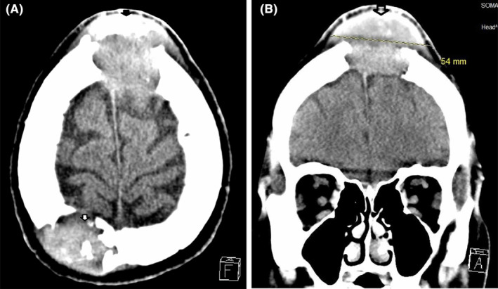 Figure 5