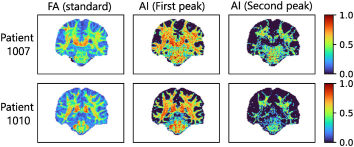 Figure 10