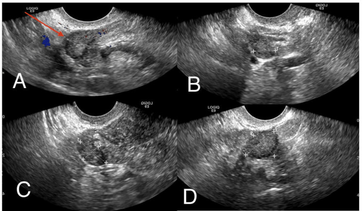 Figure 6