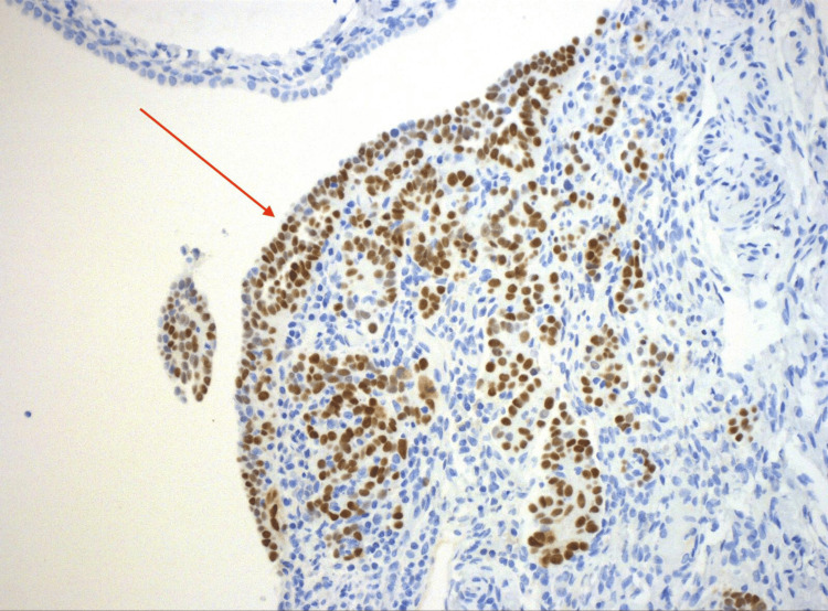 Figure 10
