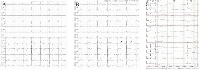 FIGURE 1