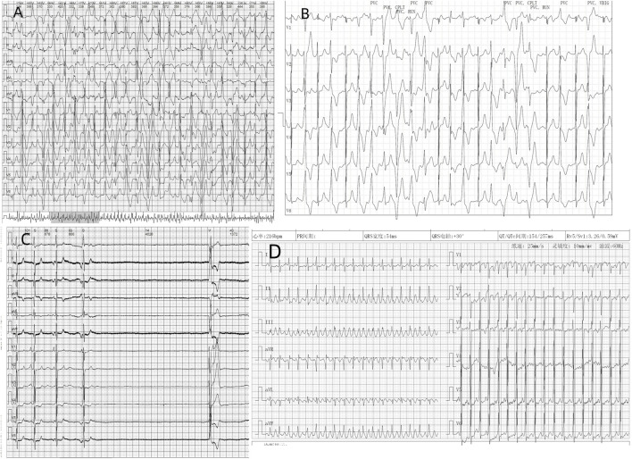 FIGURE 2