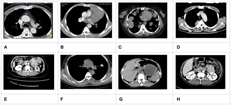 Figure 4