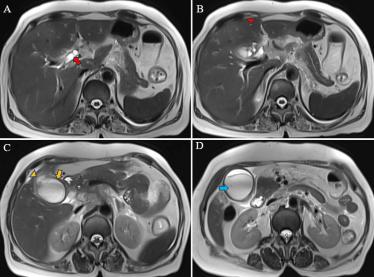 Figure 9
