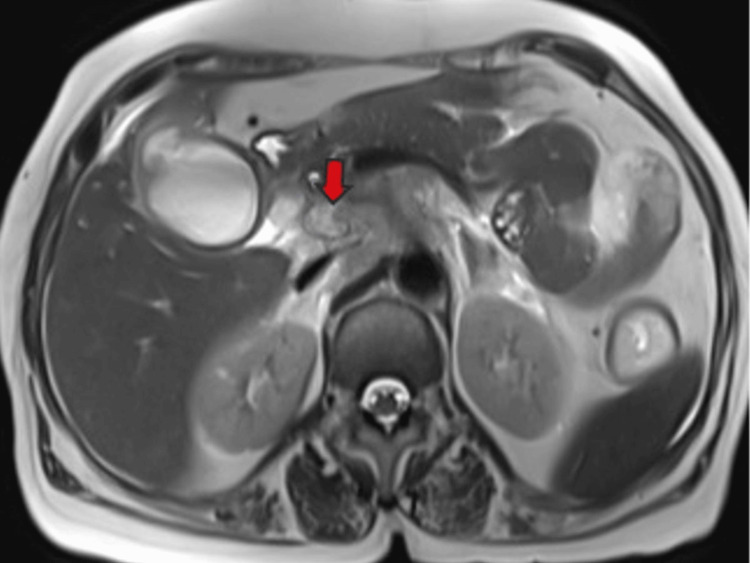 Figure 11
