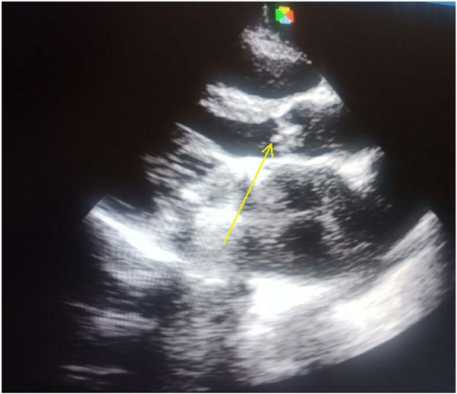 FIGURE 3