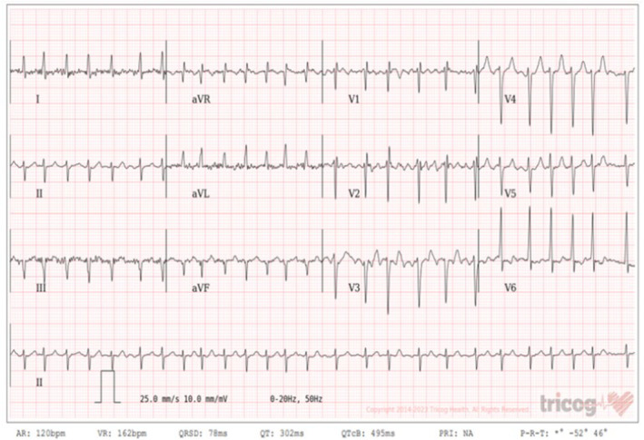 FIGURE 2