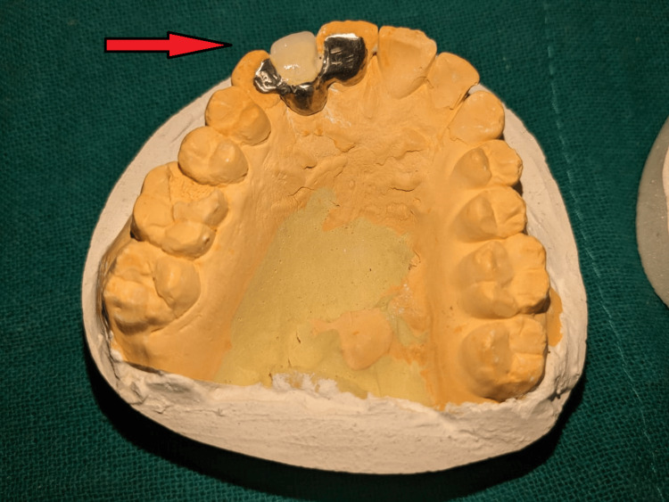 Figure 6