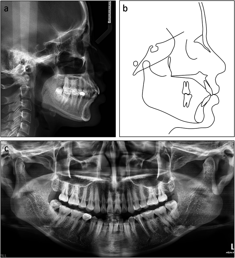 Figure 13