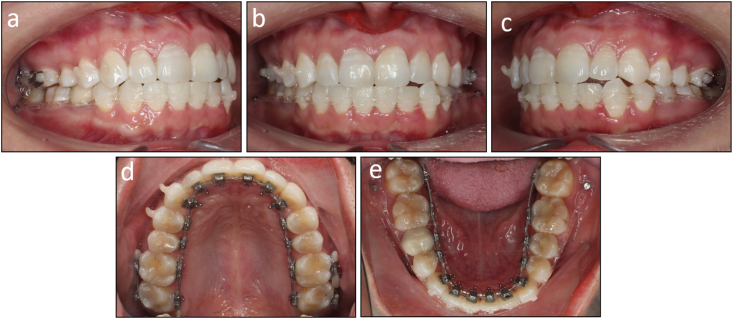 Figure 14