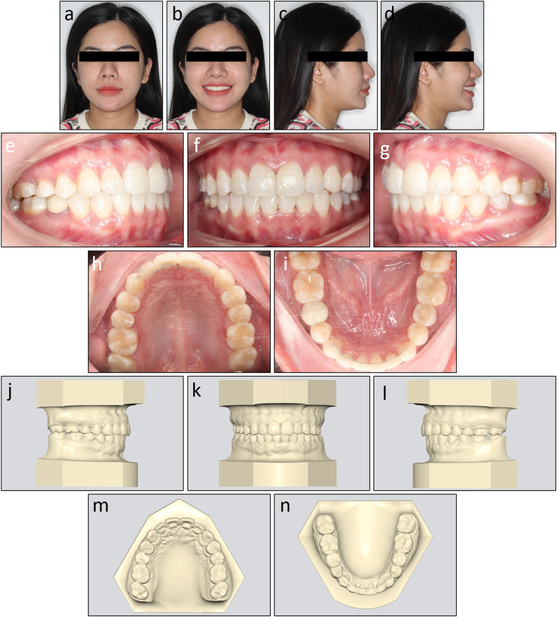 Figure 15