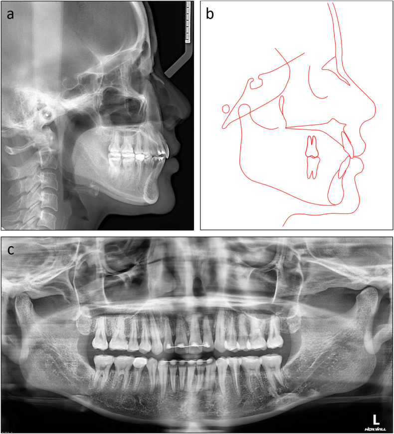 Figure 16