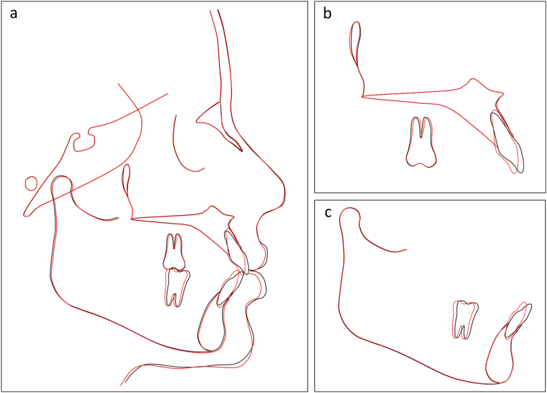 Figure 17