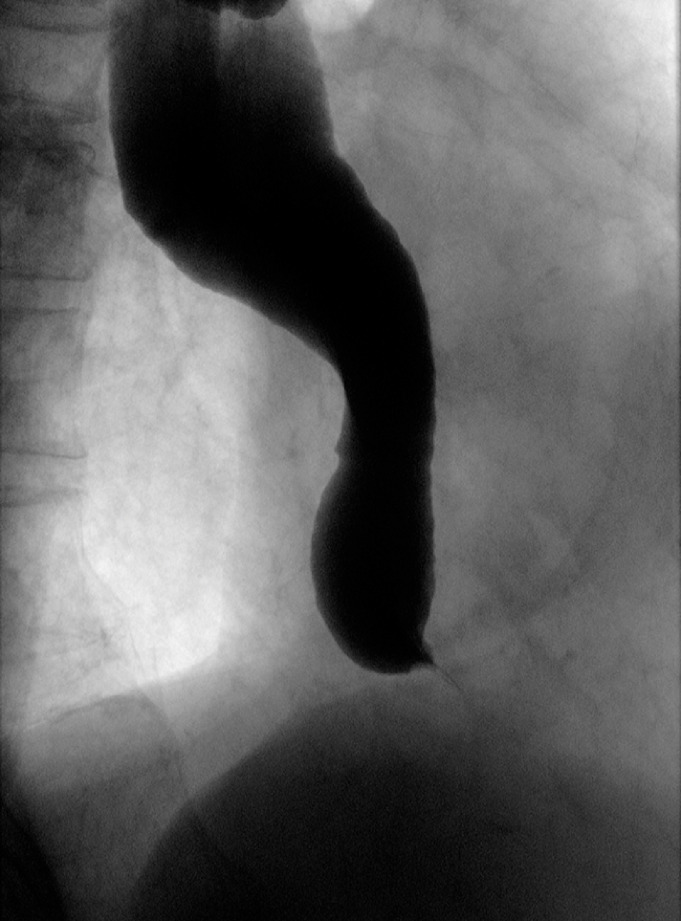 Fig. 1