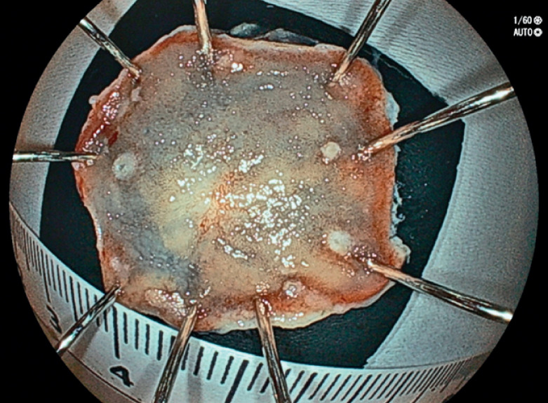 Fig. 4