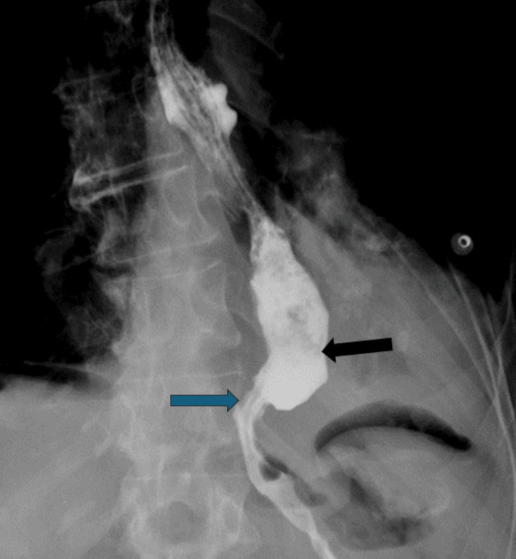 Figure 12