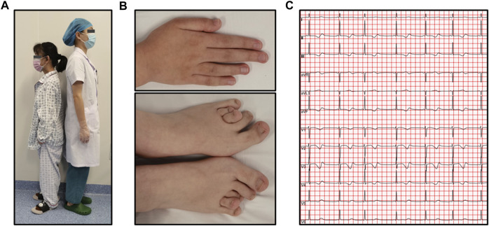 FIGURE 2