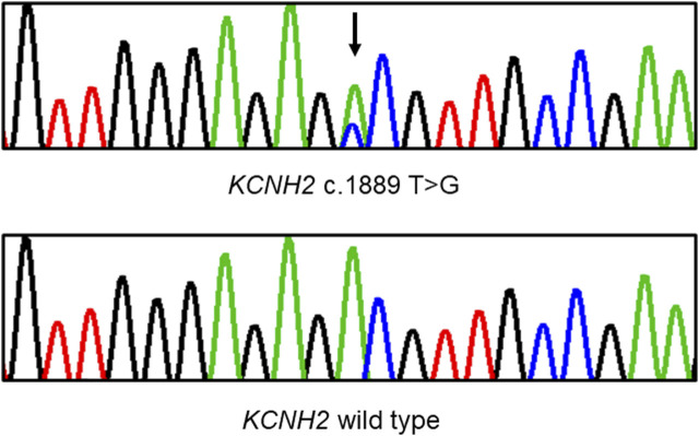 FIGURE 3
