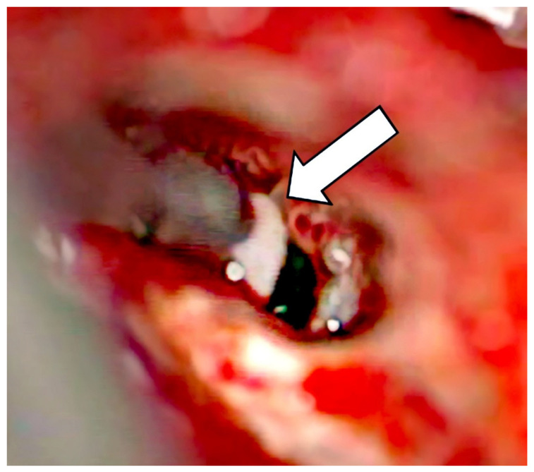 Figure 6