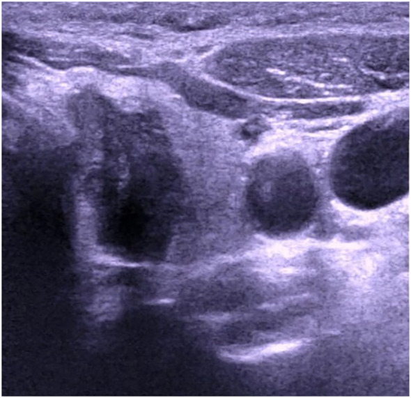 Figure 1