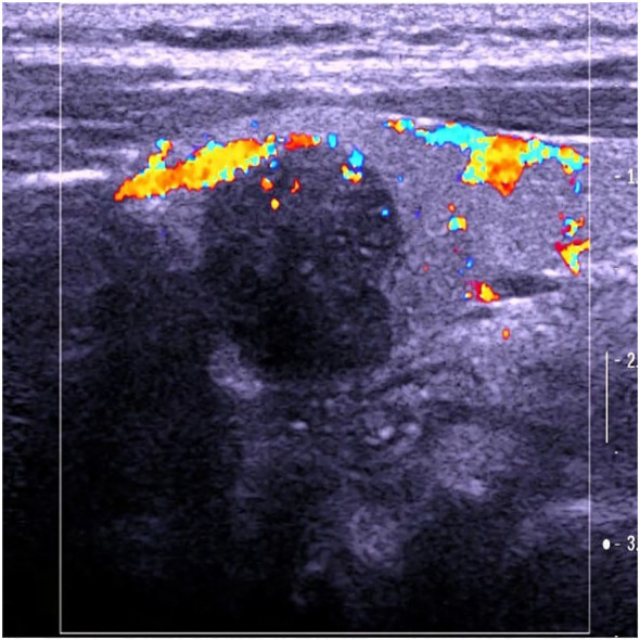 Figure 2