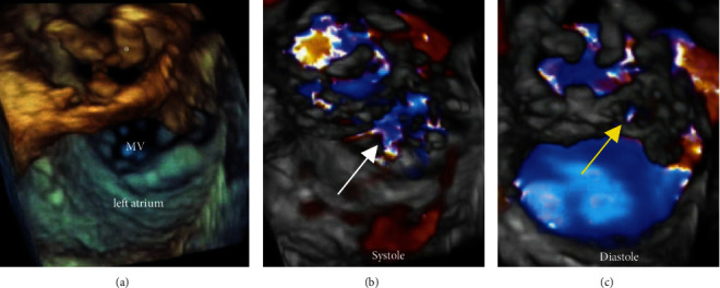 Figure 4