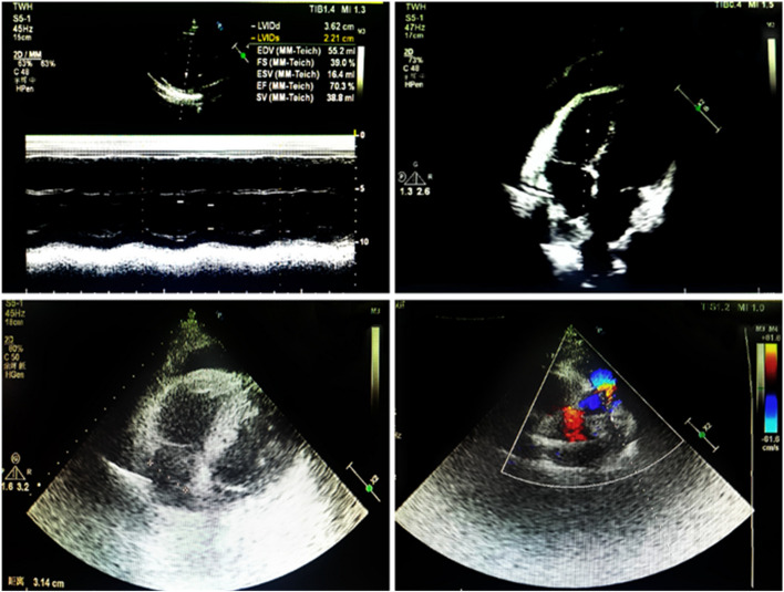 Figure 6