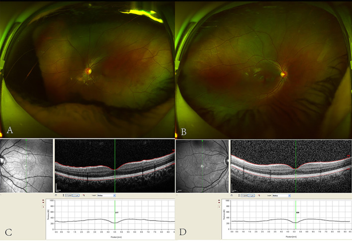 Figure 1