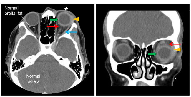 Figure 3