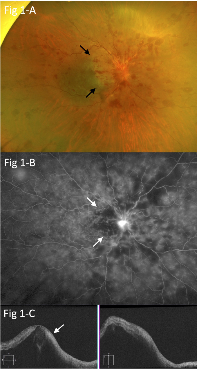 Figure 1