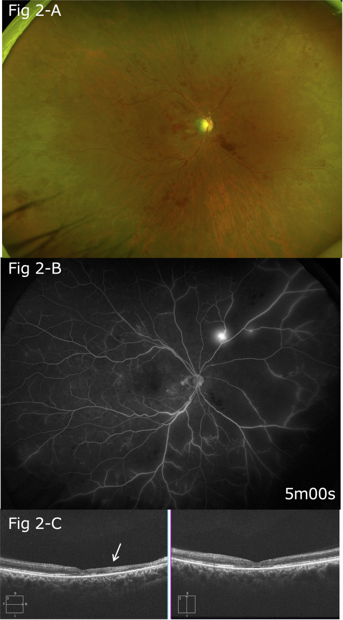 Figure 2