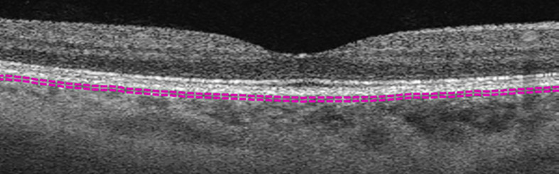 Figure 1