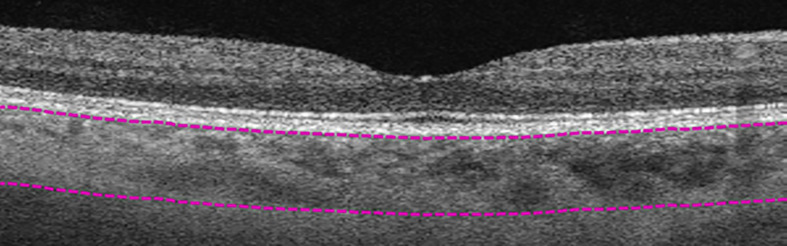 Figure 2